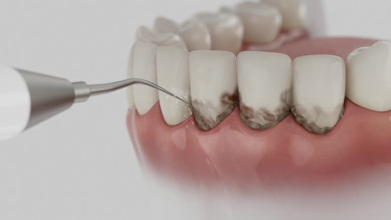 Reliable Tooth Extraction contractor in Clearlake, CA by Smile Center Dentistry